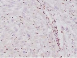 SNF5 Rabbit anti-Human, Mouse, Clone: SMARCB1/4587R, Novus Biologicals 20 &mu;g | Buy Online | Novus Biologicals | Fisher Scientific